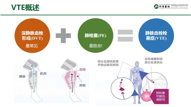 《骨科手术静脉血栓栓塞症（VTE）的预防方案》